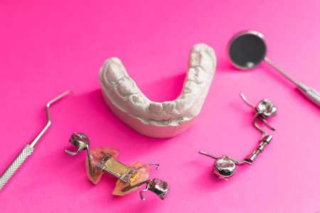 Dental casting gypsum model of human jaws. Crooked teeth and distal bite. plate for the tooth