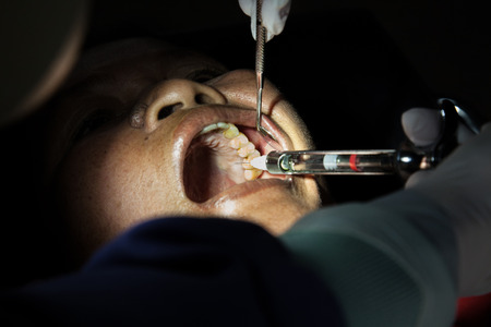 woman dentist making local anesthesia by syringe medical equipment at dental clinic の写真素材