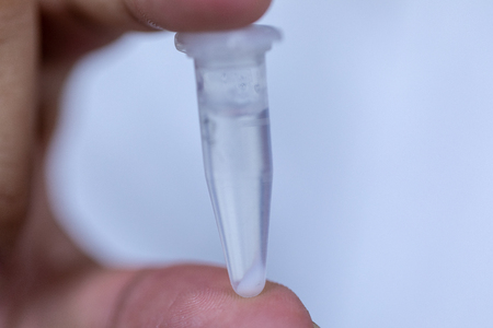 Analysis protein for study Chemical composition in laboratory.
