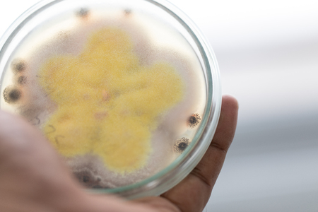 Mold Beautiful, Colony of Characteristics of Fungus (Mold) in culture medium plate from laboratory microbiology.の写真素材