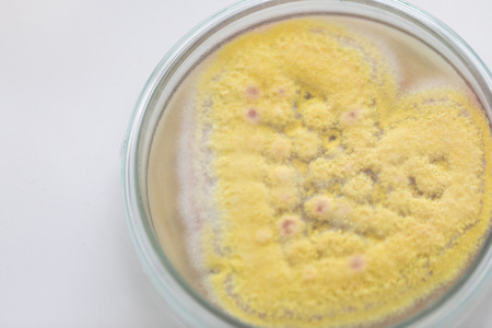 Mold Beautiful, Colony of Characteristics of Fungus (Mold) in culture medium plate from laboratory...