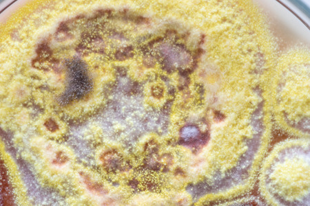 Mold Beautiful, Colony of Characteristics of Fungus (Mold) in culture medium plate from laboratory...