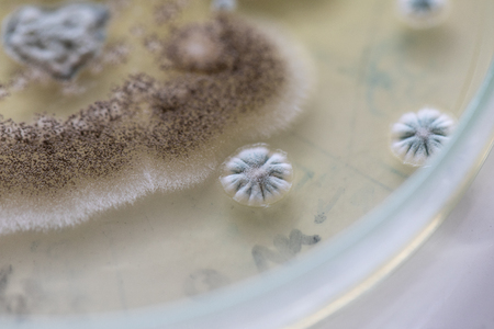 Mold Beautiful, Colony of Characteristics of Fungus (Mold) in culture medium plate from laboratory...