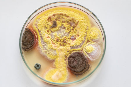 Mold Beautiful, Colony of Characteristics of Fungus (Mold) in culture medium plate from laboratory...