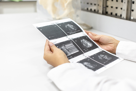 Doctor reading ultrasound results of a pregnant woman.の写真素材