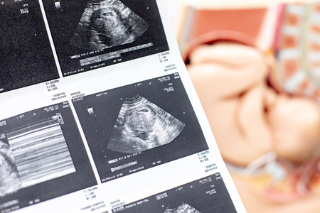 Doctor reading ultrasound results of a pregnant woman.の写真素材