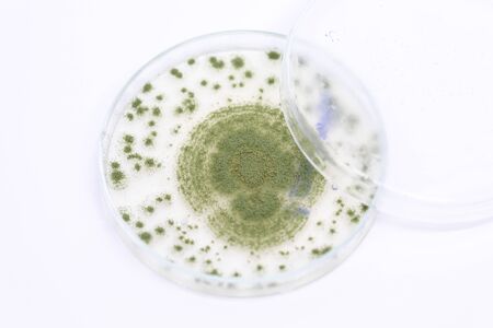 Close up of Aspergillus oryzae is a filamentous fungus, or mold that is used in food production, such as in soybean fermentation for education in laboratory.(soft focus and have Grain/Noise)の写真素材