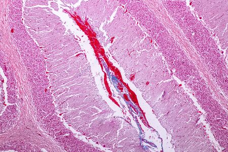 Cerebellum and Nerve human under the microscope for education in Lab.