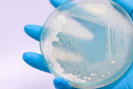 Yeast in petri dish, Microbiology for education in laboratories.
