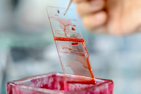 The study parasite or worms is a freshwater fish parasite in laboratory for education.