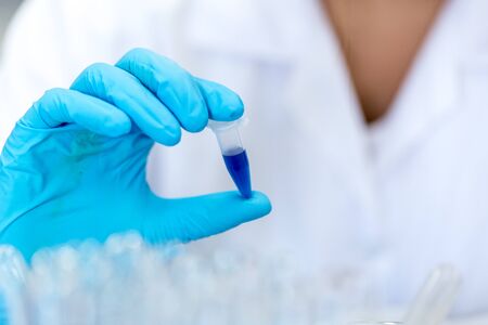 Biochemical analysis and Chemical analysis in Lab.