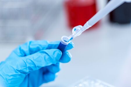 Biochemical analysis and Chemical analysis in Lab.