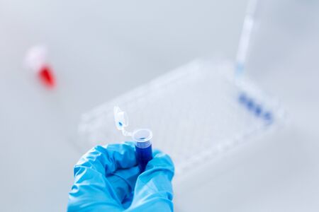 Biochemical analysis and Chemical analysis in Lab.