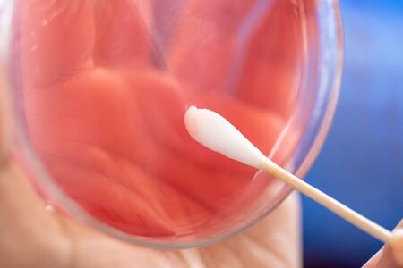 Study for Bacteria (Staphylococcus aureus) in the human nose, for study on Blood Agar Culture Plate...