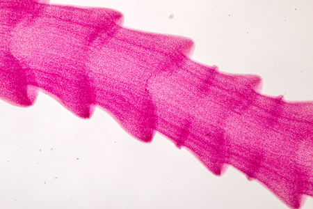 Patterns and backgrounds of Parasitic, Study for Anatomical pathology in laboratory.の写真素材