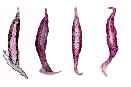 Patterns and backgrounds of Parasitic, Study for Anatomical pathology in laboratory.の写真素材