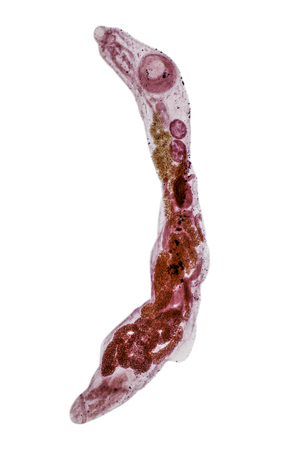 Patterns and backgrounds of Parasitic, Study for Anatomical pathology in laboratory.の写真素材