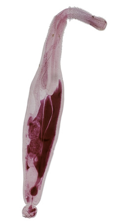 Patterns and backgrounds of Parasitic, Study for Anatomical pathology in laboratory.の写真素材