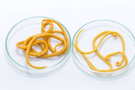 Ascariasis is a disease caused by the parasitic roundworm Ascaris lumbricoides for education in...
