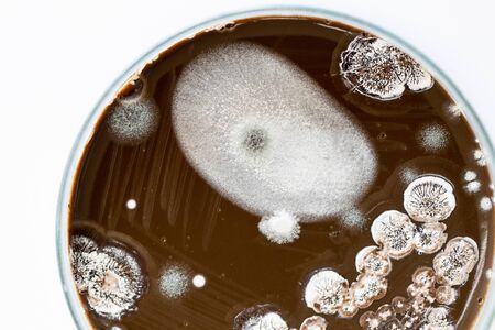 Colony characteristic of Actinomyces, Bacteria, yeast and Mold on selective media from soil samples...
