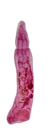 Parasitic, Study of Parasitic and Anatomical pathology in laboratory.
