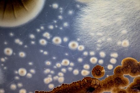 Characteristics and Different shaped Colony of Bacteria and Mold growing on agar plates from Soil...