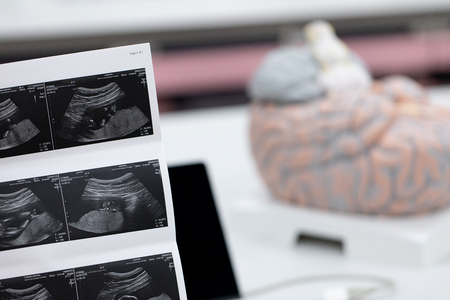 Ultrasound of baby in mother's at hospital.の写真素材