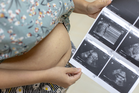 Ultrasound of baby in mother's at hospital.