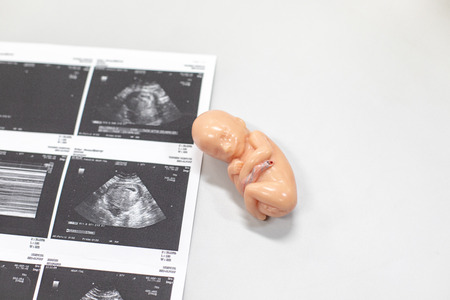 Ultrasound of baby in mother's at hospital.の写真素材