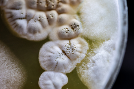 Colony characteristic of Actinomyces, Bacteria, yeast and Mold on selective media from soil samples for study in laboratory microbiology.の写真素材