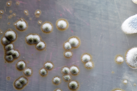 Colony characteristic of Actinomyces, Bacteria, yeast and Mold on selective media from soil samples for study in laboratory microbiology.の写真素材