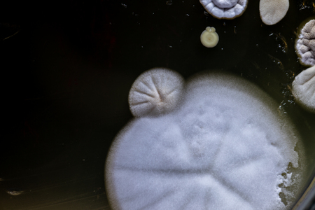 Colony characteristic of Actinomyces, Bacteria, yeast and Mold on selective media from soil samples...