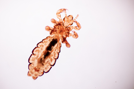 The head louse (Pediculus humanus capitis) is a parasite Live on the body, person or animal and live by sucking blood into food.の写真素材