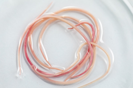 Ascariasis is a disease caused by the parasitic roundworm Ascaris lumbricoides for education in...