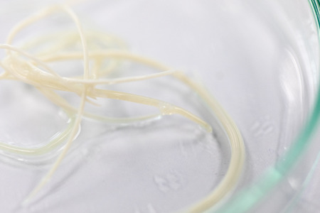 Ascariasis is a disease caused by the parasitic roundworm Ascaris lumbricoides for education in laboratories.の写真素材