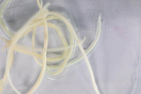 Ascariasis is a disease caused by the parasitic roundworm Ascaris lumbricoides for education in laboratories.の写真素材