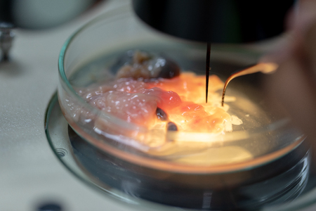 Ascariasis is a disease caused by the parasitic roundworm Ascaris lumbricoides for education in laboratories.の写真素材