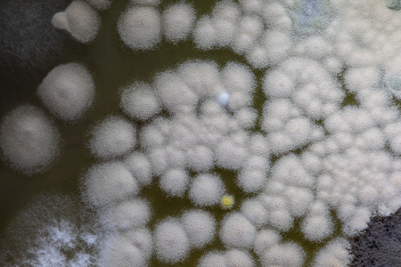 Colony characteristic of Actinomyces, Bacteria, yeast and Mold on selective media from soil samples...