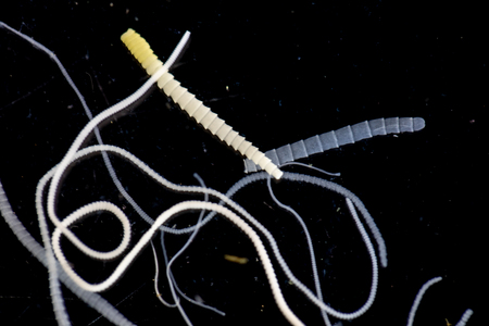 The study of Tapeworm infection is caused by ingesting food or water contaminated with tapeworm eggs...