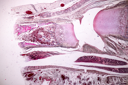 Study Histology of human, tissue bone under the microscopic in laboratory.