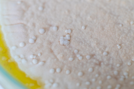 Colony characteristic of Actinomyces, Bacteria, yeast and Mold on selective media from soil samples...
