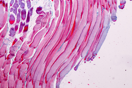 Education anatomy and Histological sample Striated (Skeletal) muscle of mammal Tissue under the...