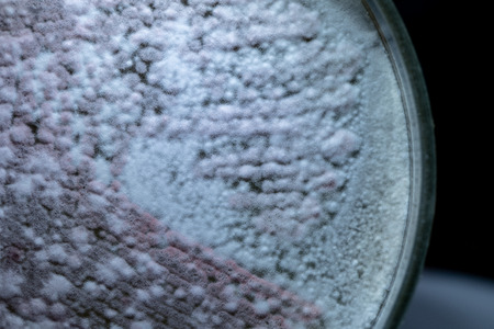 Colony characteristic of Actinomyces, Bacteria, yeast and Mold on selective media from soil samples...