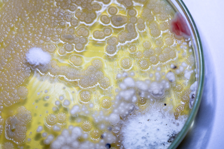 Colony characteristic of Actinomyces, Bacteria, yeast and Mold on selective media from soil samples...