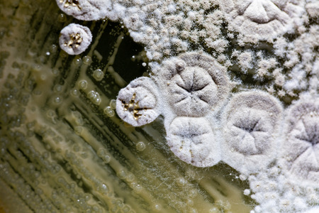 Colony characteristic of Actinomyces, Bacteria, yeast and Mold on selective media from soil samples for study in laboratory microbiology.の写真素材