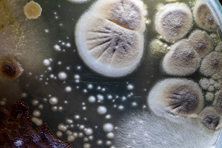 Colony characteristic of Actinomyces, Bacteria, yeast and Mold on selective media from soil samples for study in laboratory microbiology.の写真素材