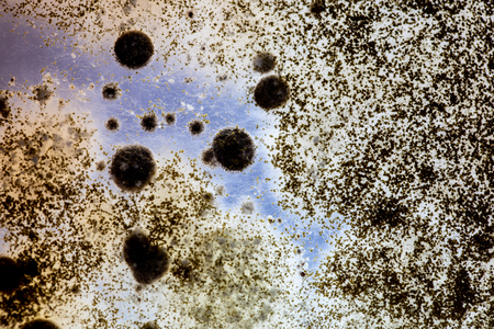 Colony characteristic of Actinomyces, Bacteria, yeast and Mold on selective media from soil samples...