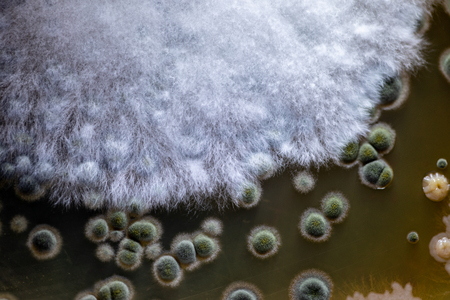 Colony characteristic of Actinomyces, Bacteria, yeast and Mold on selective media from soil samples for study in laboratory microbiology.の写真素材