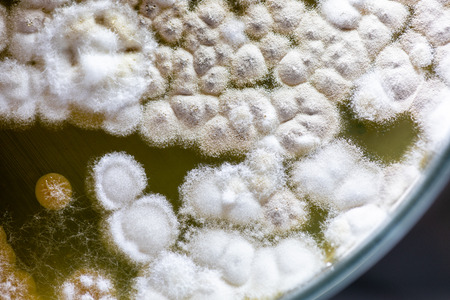 Colony characteristic of Actinomyces, Bacteria, yeast and Mold on selective media from soil samples for study in laboratory microbiology.の写真素材