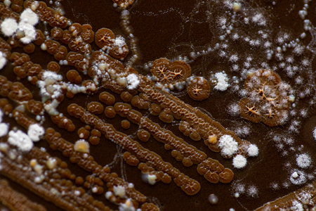 Backgrounds of Characteristics and Different shaped Colony of Bacteria and Mold growing on agar...